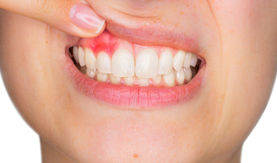 Periodontoloji nedir?